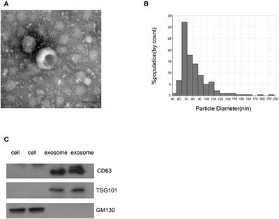 Circulating Exosomal miR-150-5p and miR-99b-5p as Diagnostic Biomarkers for Colorectal Cancer